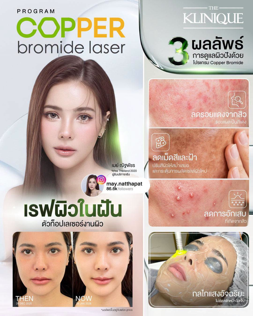 รีวิวรักษาสิวที่ THE KLINIQUE