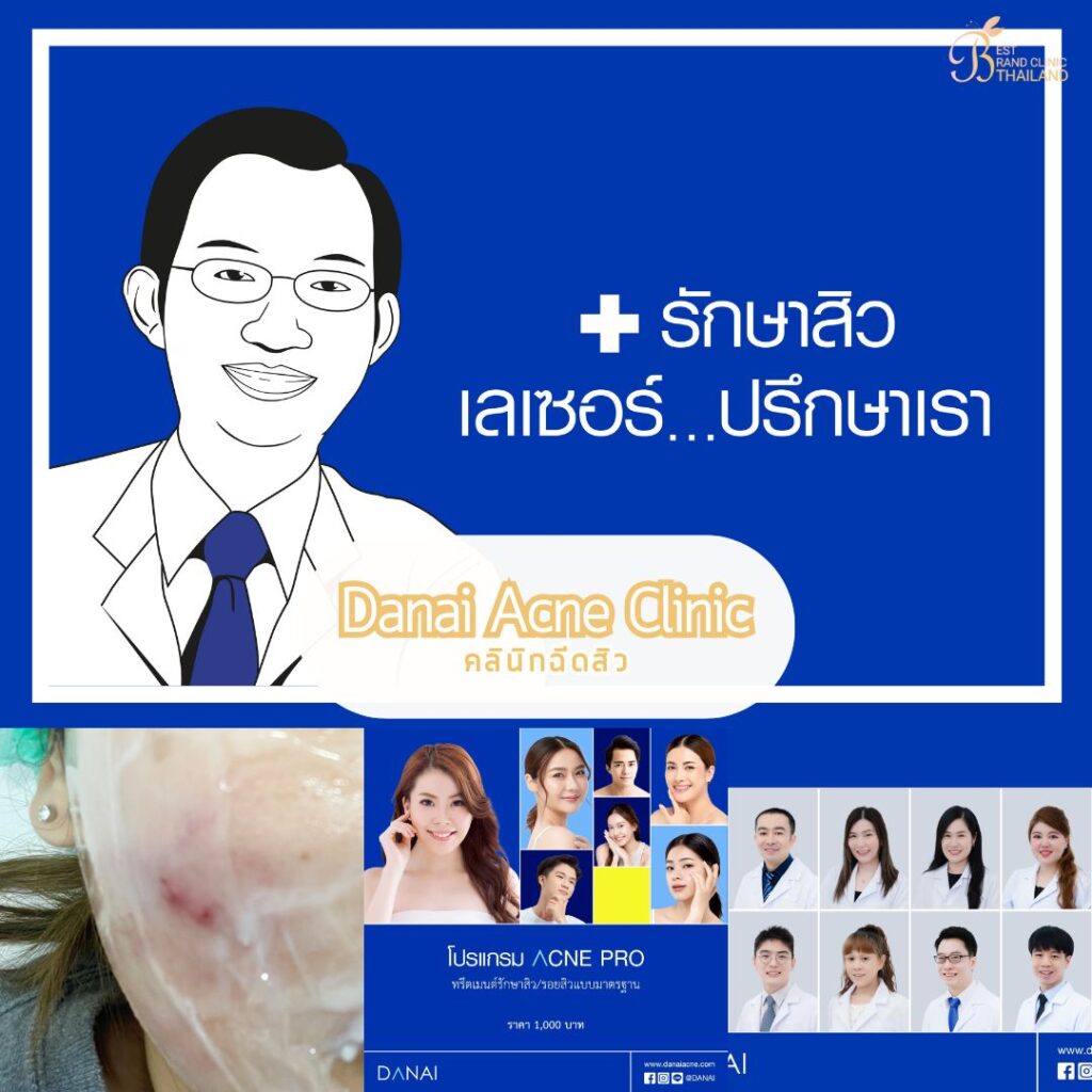 Danai Acne Clinic