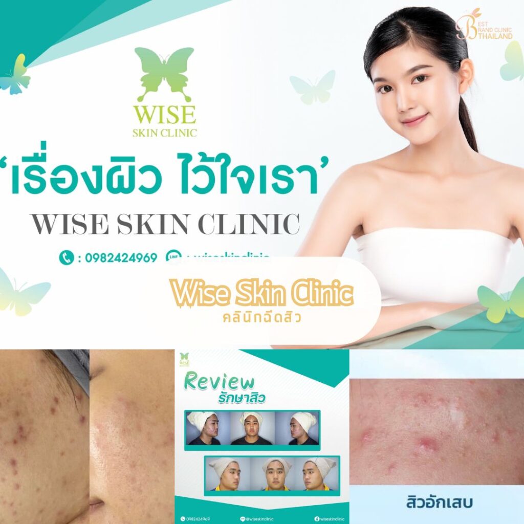 Wise Skin Clinic