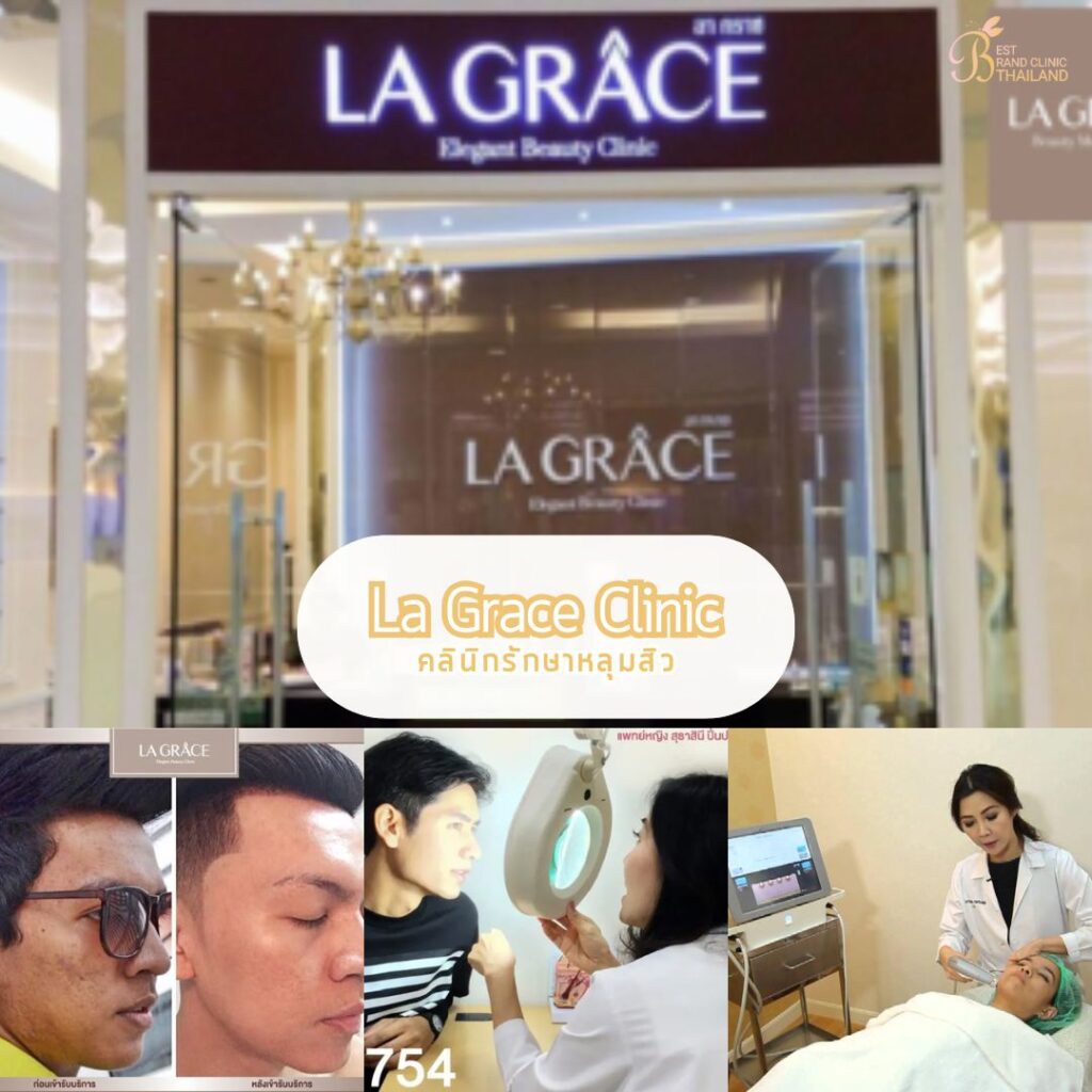 รักษาหลุมสิว ที่ La Grace Clinic