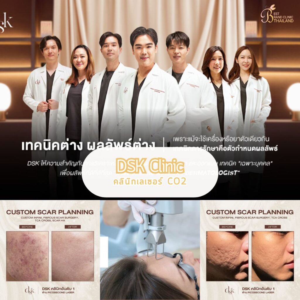 เลเซอร์ CO2 DKS Clinic