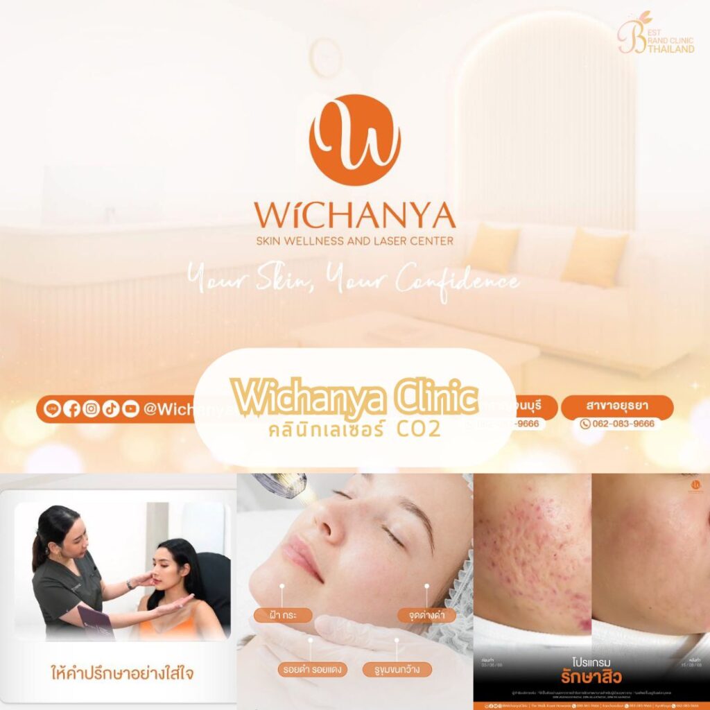 เลเซอร์ CO2 Wichanya Clinic