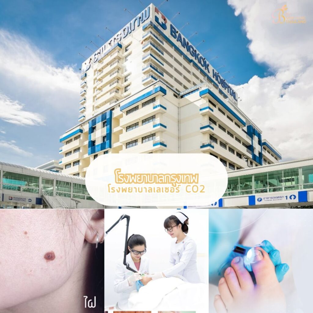 เลเซอร์ CO2 โรงพยาบาลกรุงเทพ