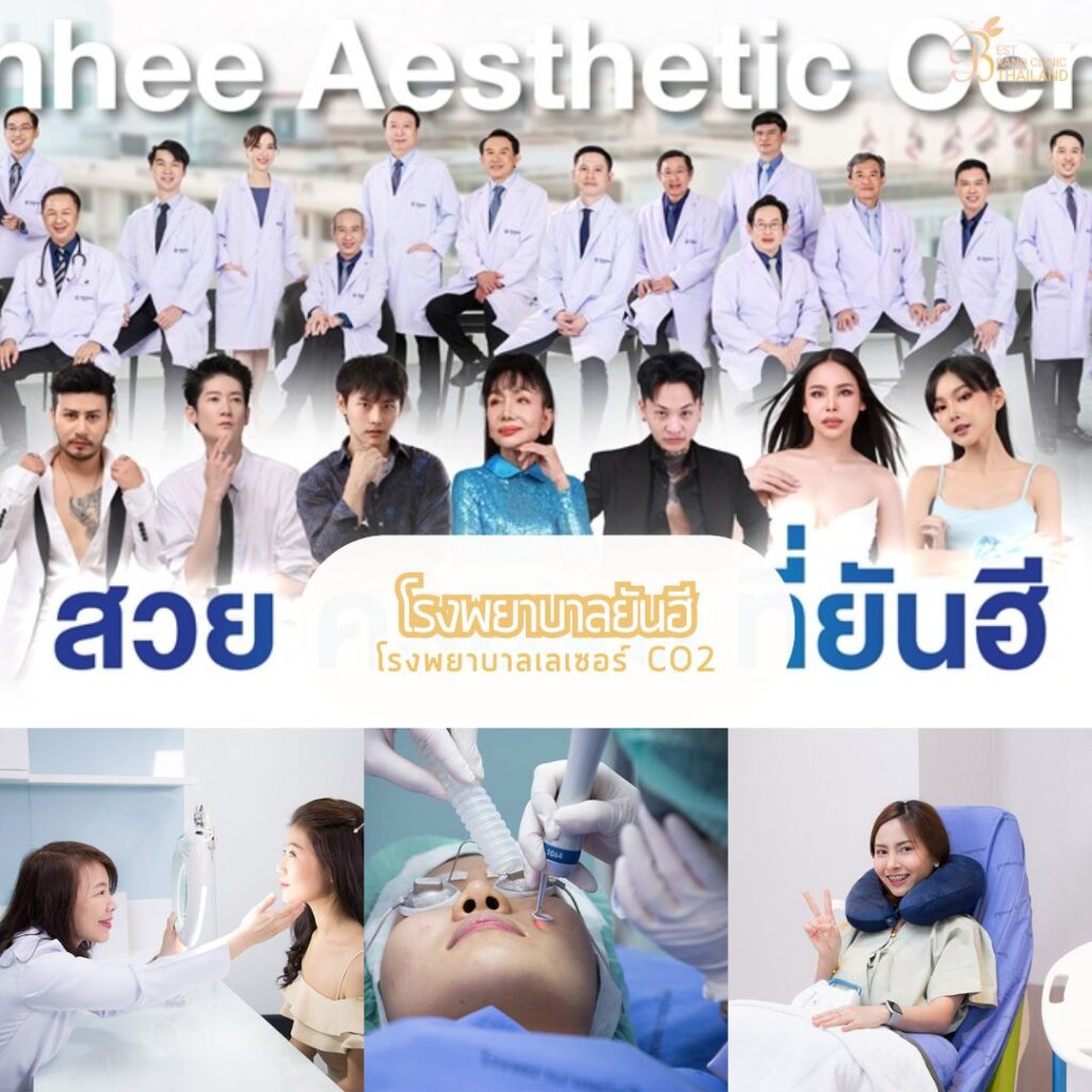 เลเซอร์ CO2 เลเซอร์ CO2 โรงพยาบาลยันฮี