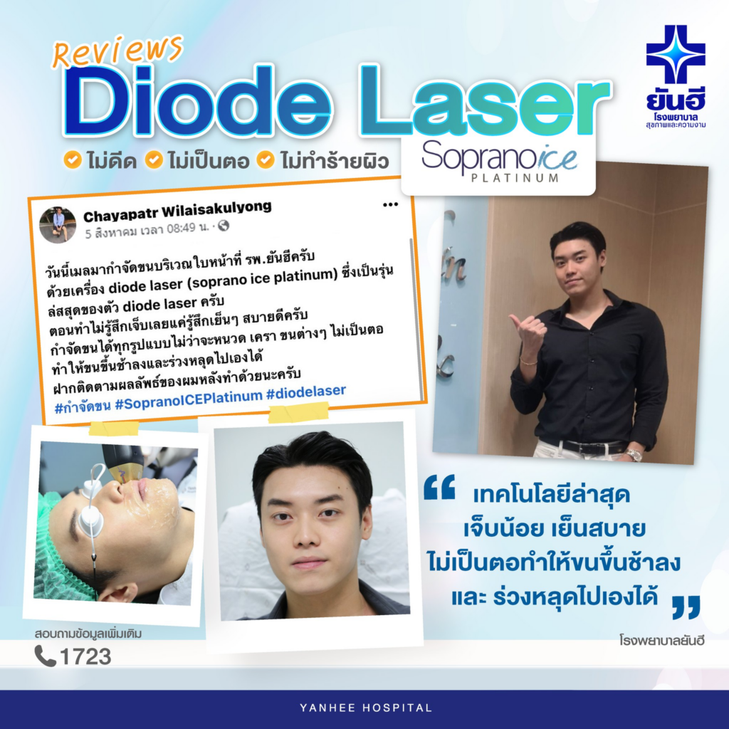 รีวิวเลเซอร์ขนที่ Yanhee Hospital