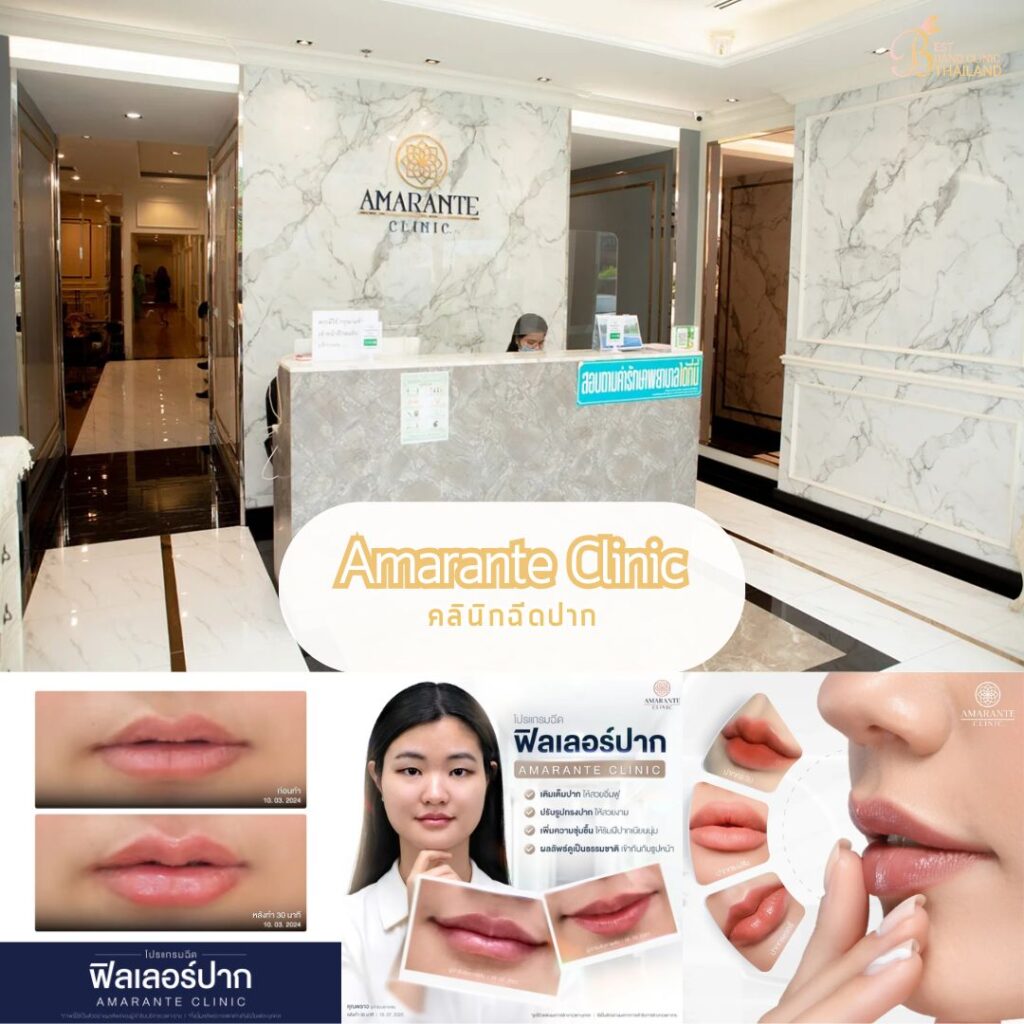 ฉีดปากที่ Amarante Clinic