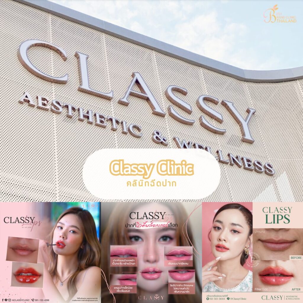 ฉีดปากที่ Classy Clinic