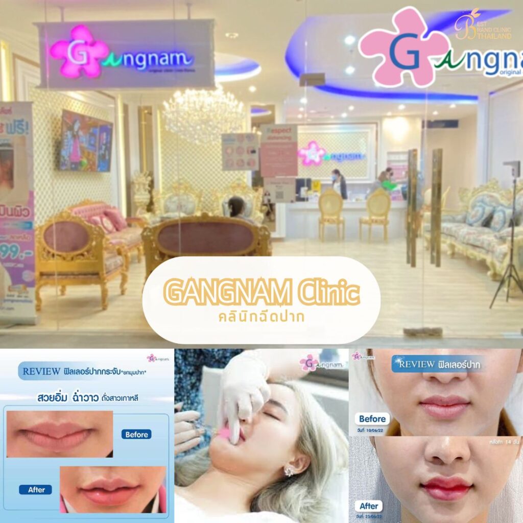 ฉีดปากที่ กังนัมคลินิก