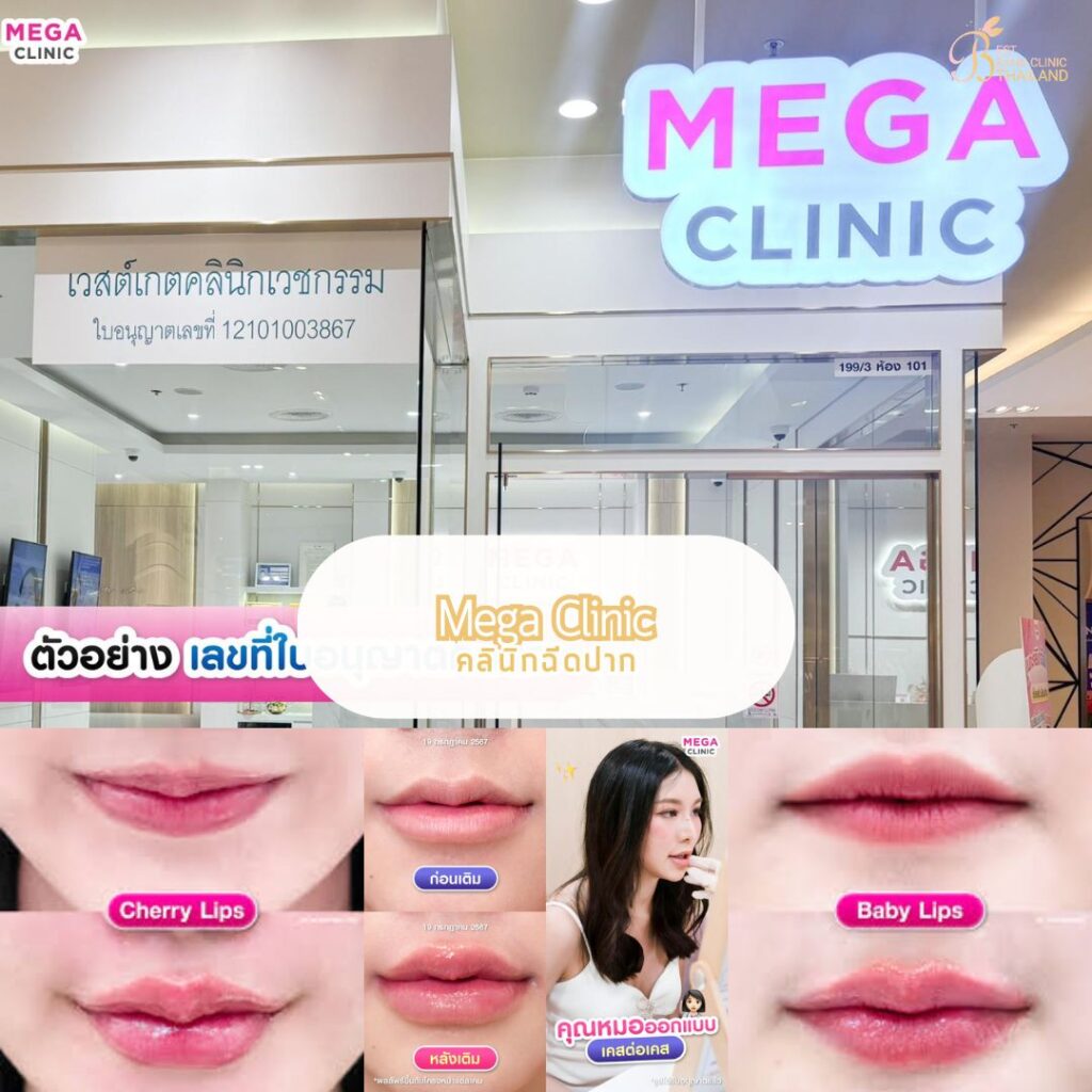 ฉีดปากที่ Mega Clinic