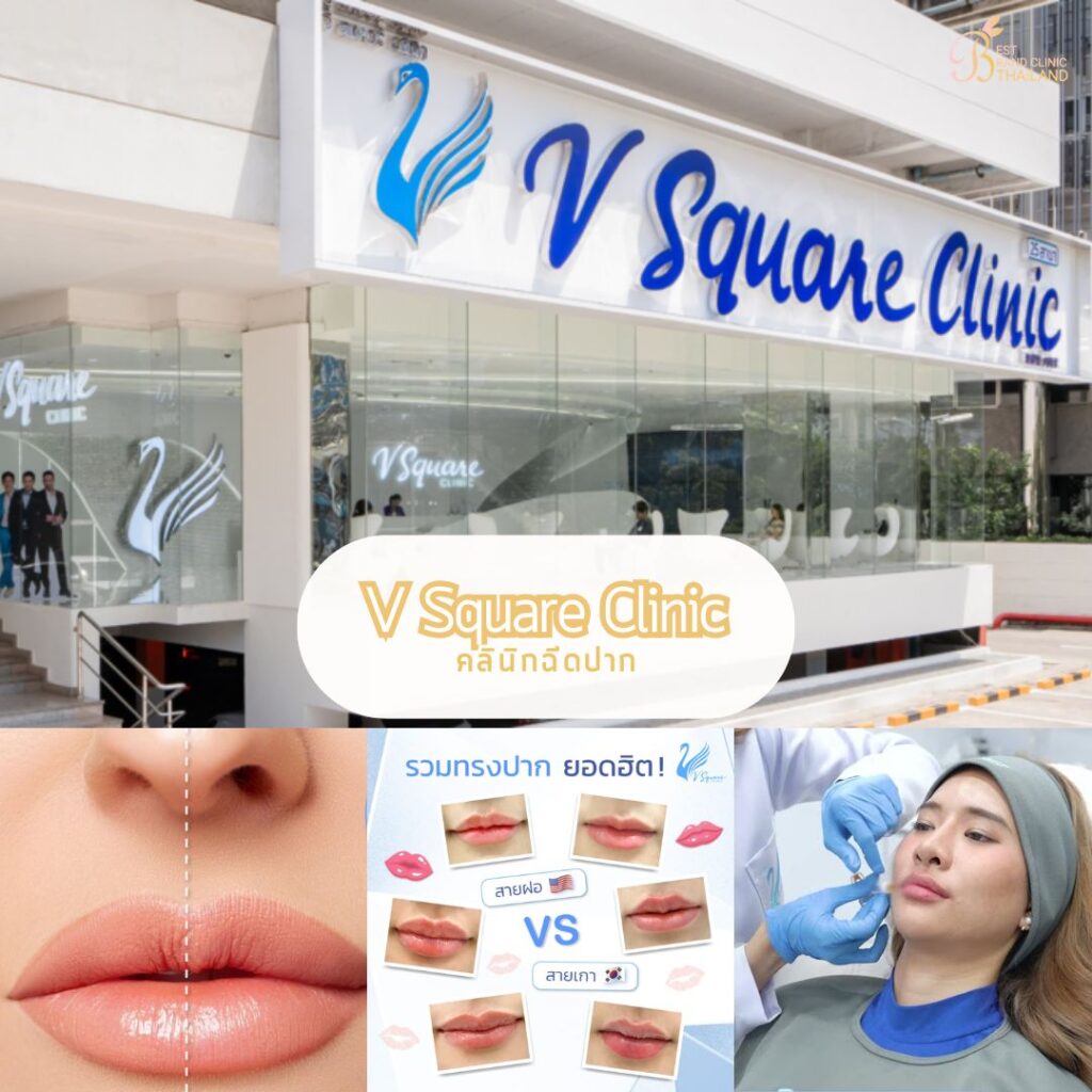 ฉีดปากที่ V Square Clinic