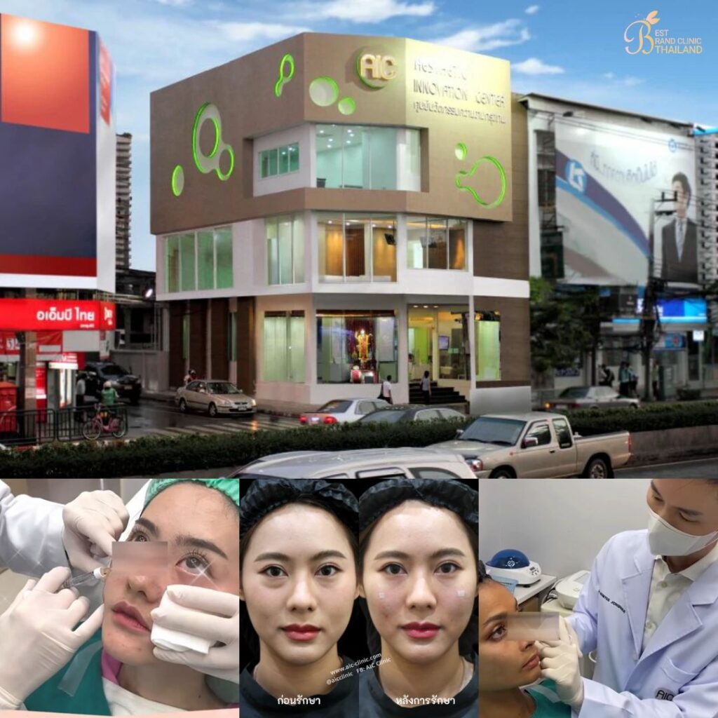 ฉีดฟิลเลอร์ใต้ตาที่ AIC Clinic