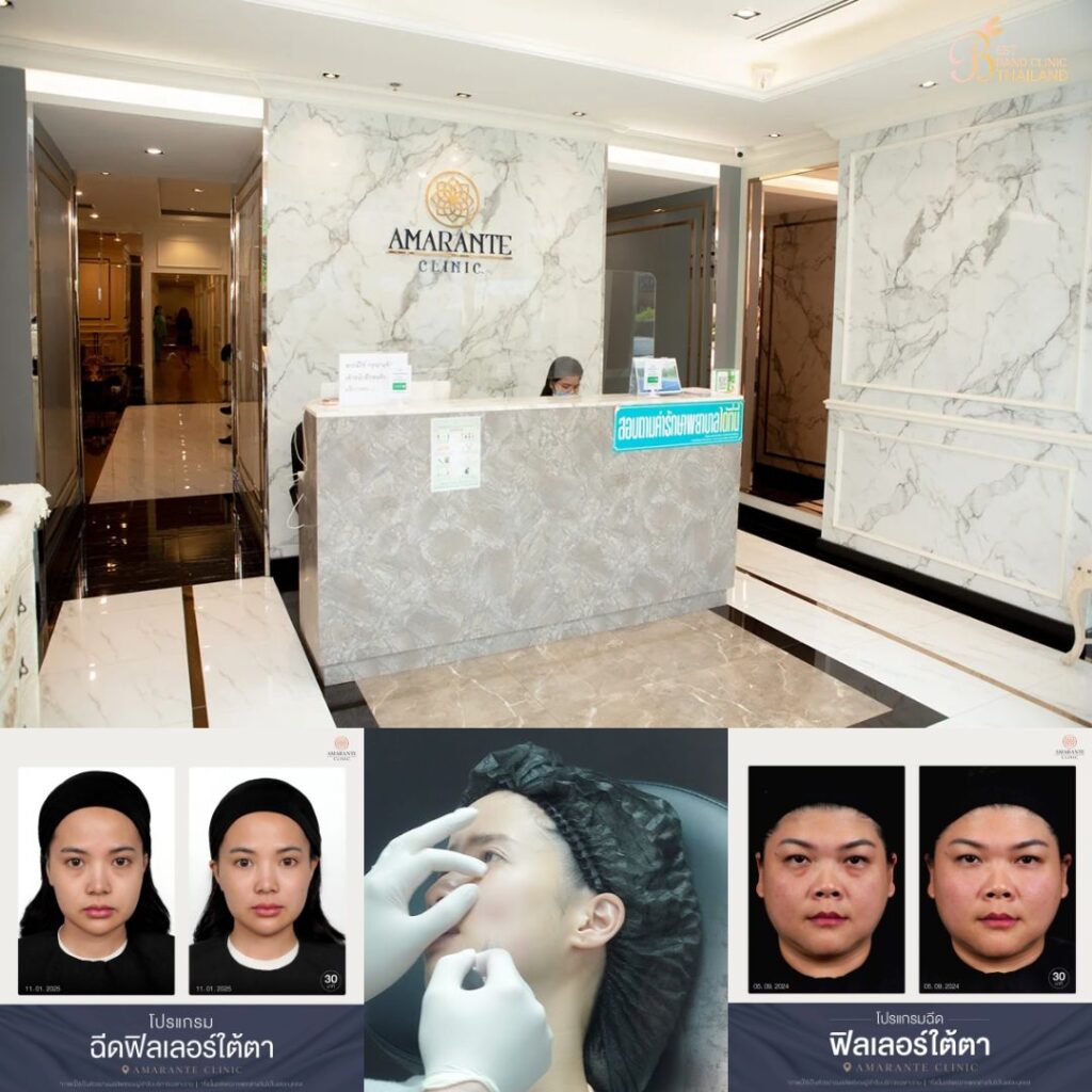 ฉีดฟิลเลอร์ใต้ตาที่ Amarante Clinic