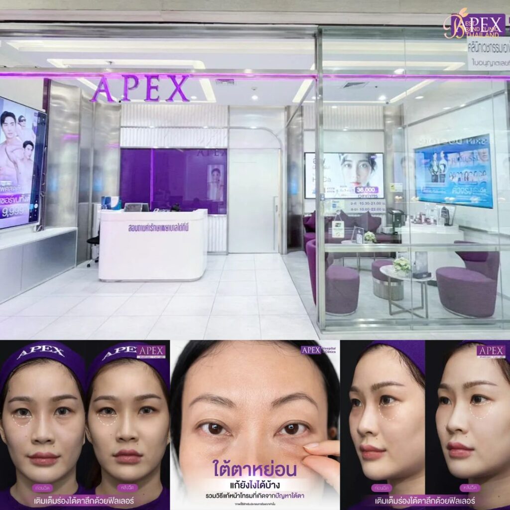 ฉีดฟิลเลอร์ใต้ตาที่ Apex Medical Center