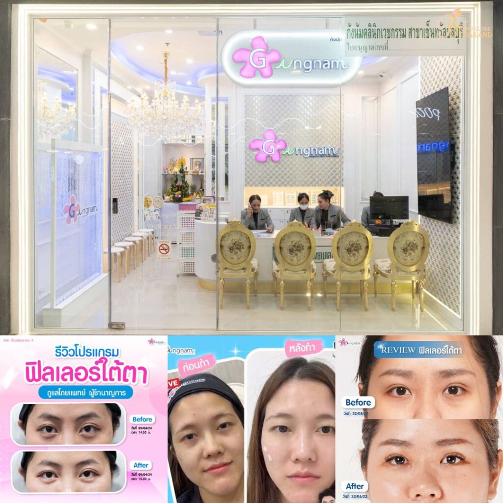 ฉีดฟิลเลอร์ใต้ตาที่ Gangnam Clinic