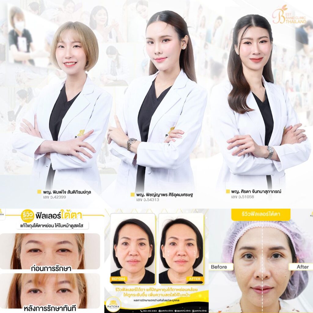 ฉีดฟิลเลอร์ใต้ตาที่ Patcha Clinic