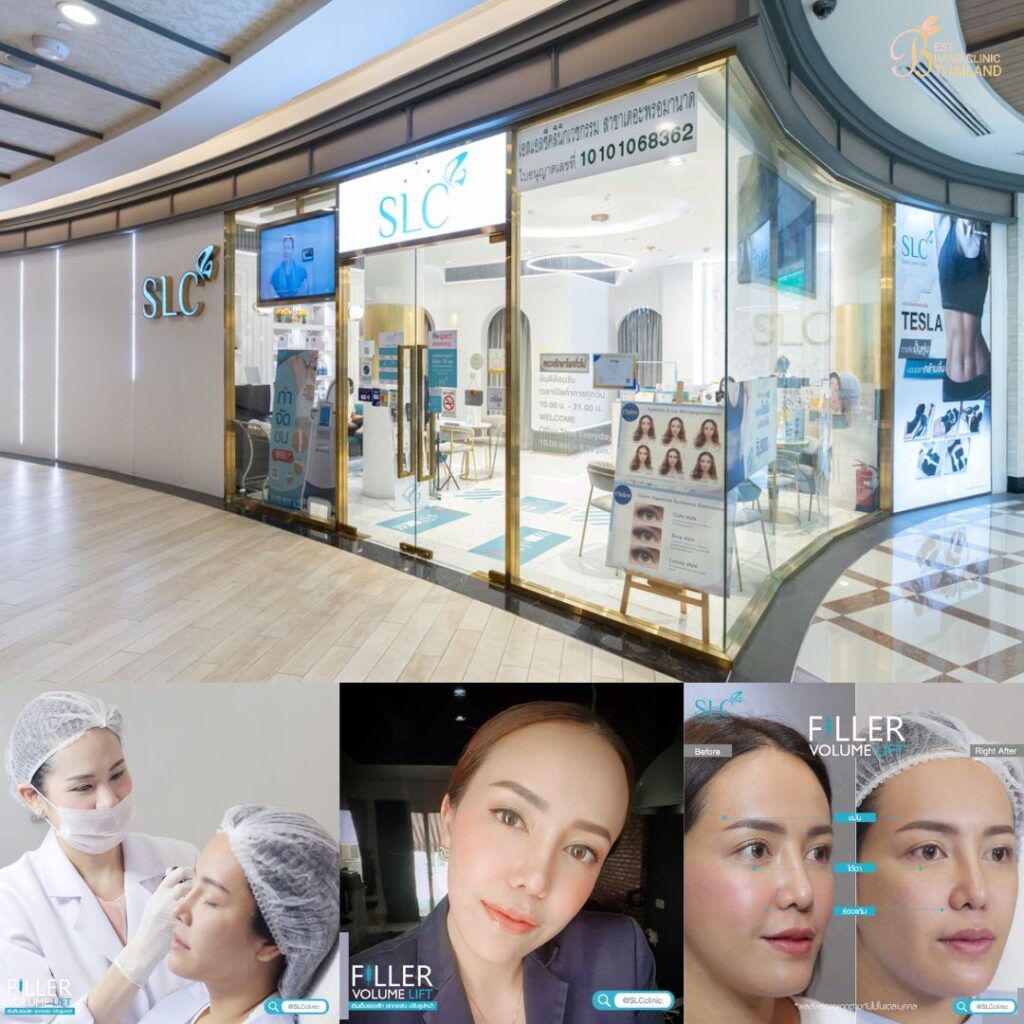 ฉีดฟิลเลอร์ใต้ตาที่ SLC Clinic