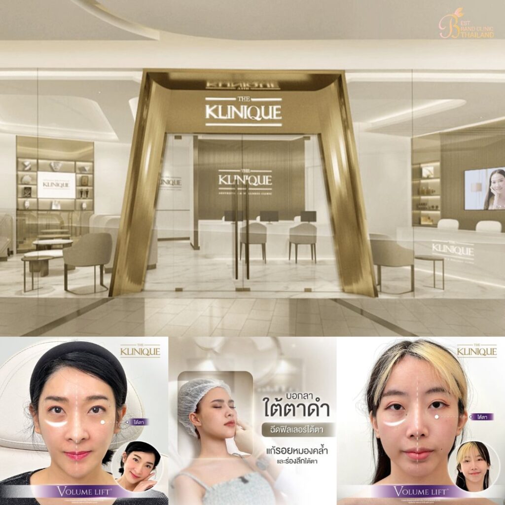 ฉีดฟิลเลอร์ใต้ตาที่ The Klinique