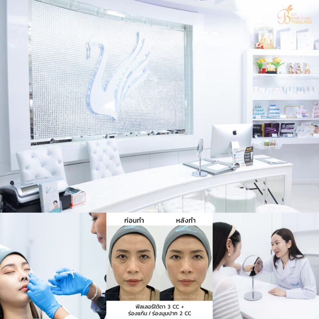 ฉีดฟิลเลอร์ใต้ตาที่ V Square Clinic