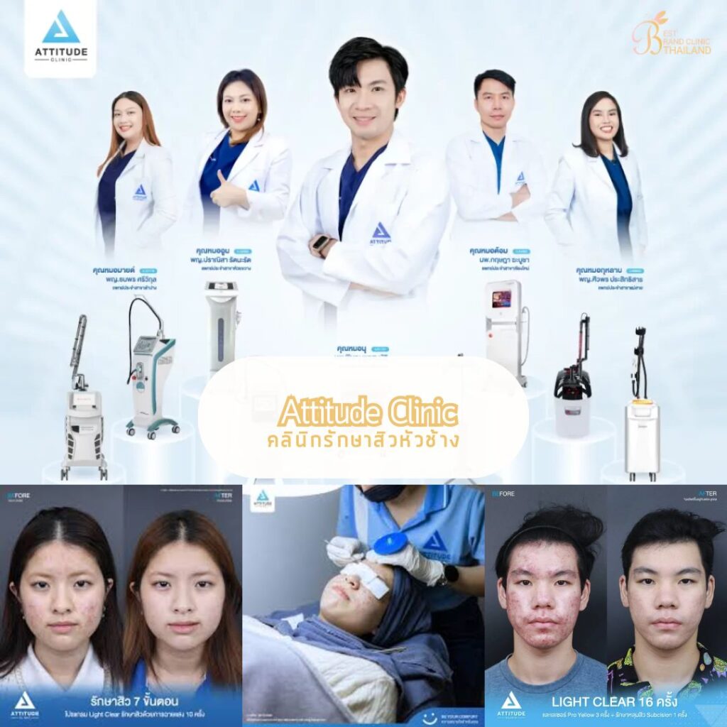 รักษาสิวหัวช้างที่ Attitude Clinic
