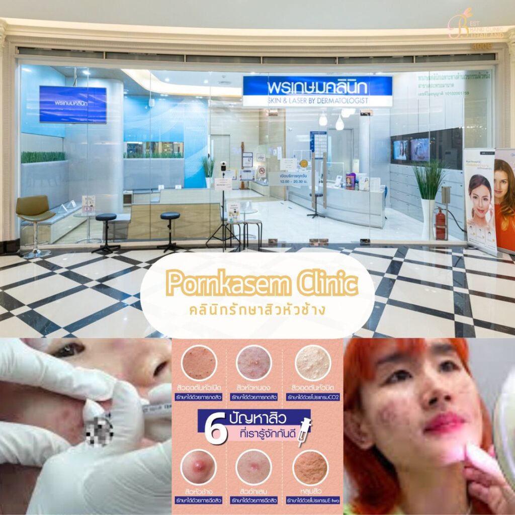 รักษาสิวหัวช้างที่ Pornkasem Clinic