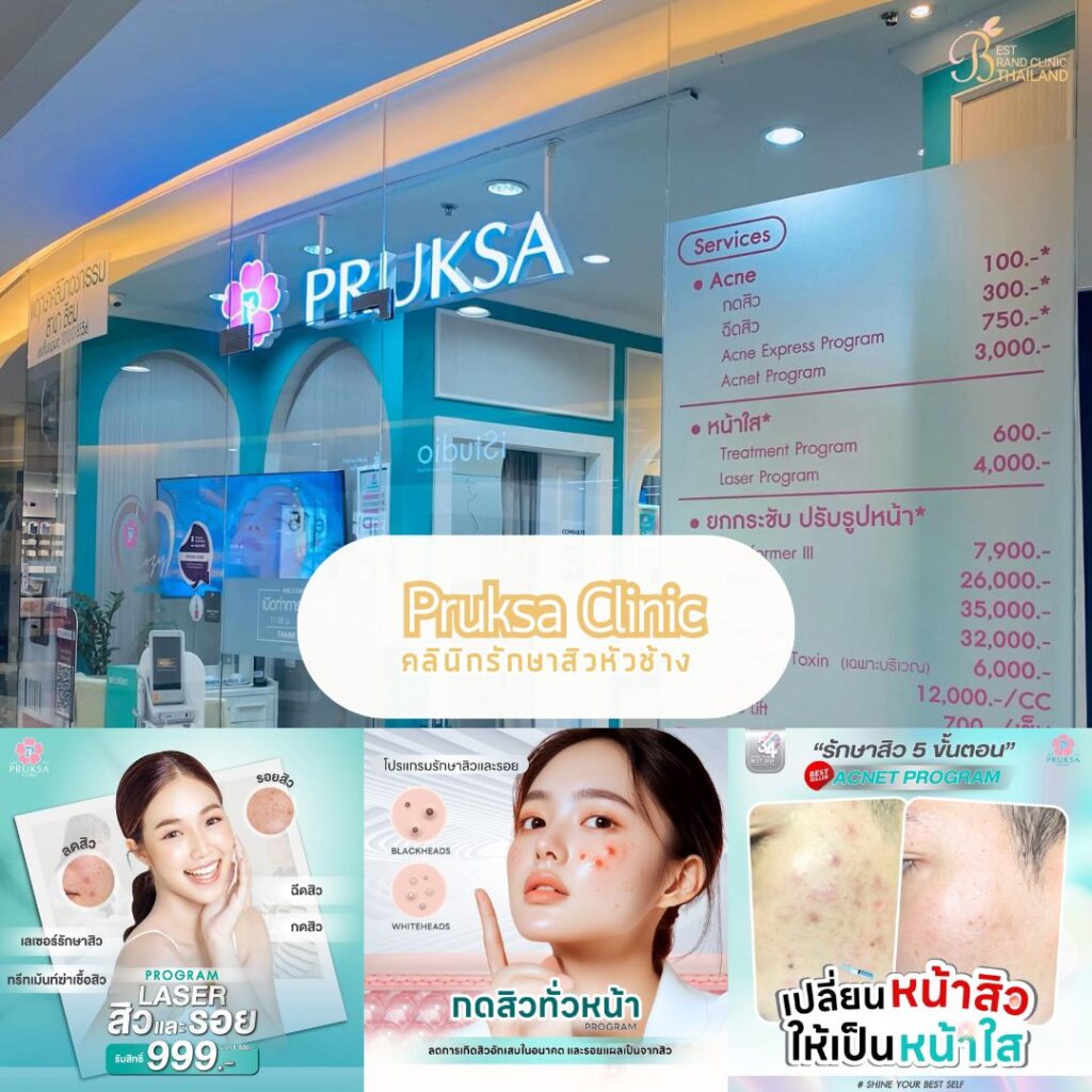 รักษาสิวหัวช้างที่ Pruksa Clinic