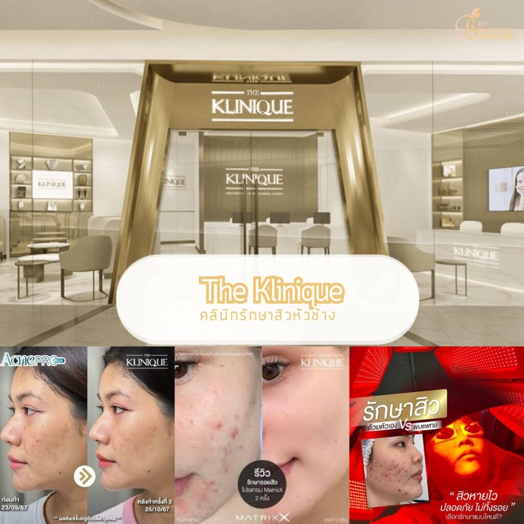 รักษาสิวหัวช้างที่ The Klinique