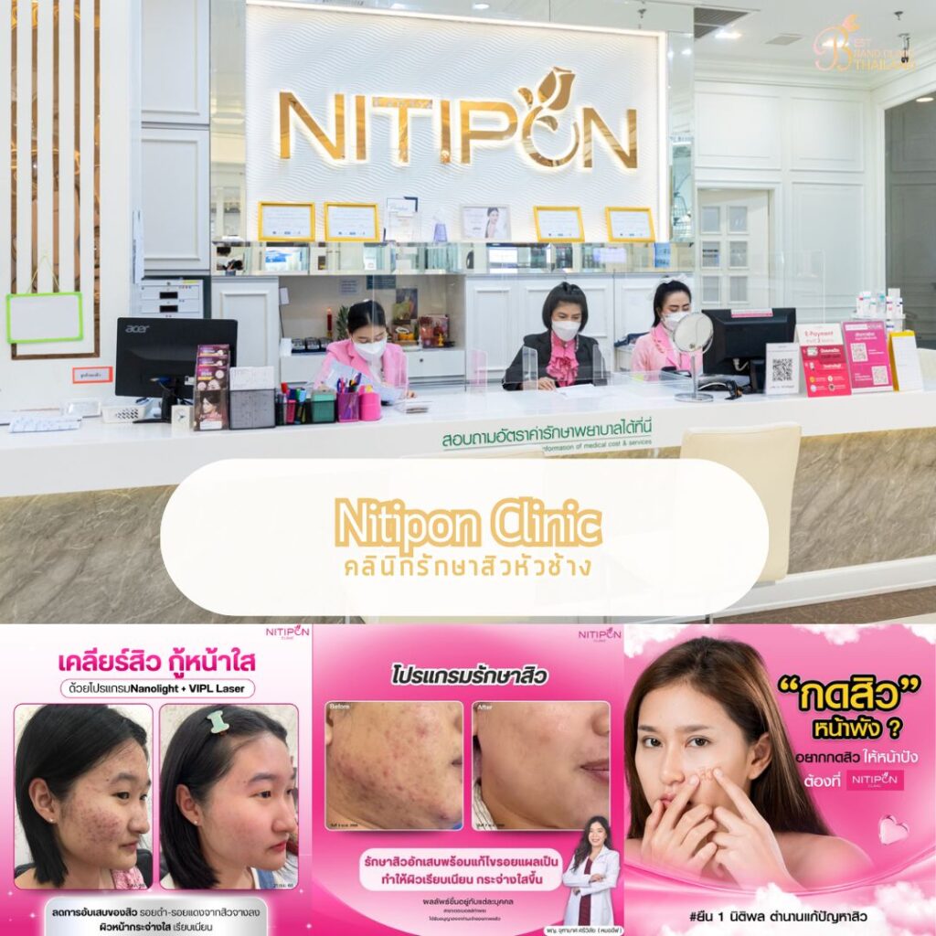 รักษาสิวหัวช้างที่ Nitipon Clinic