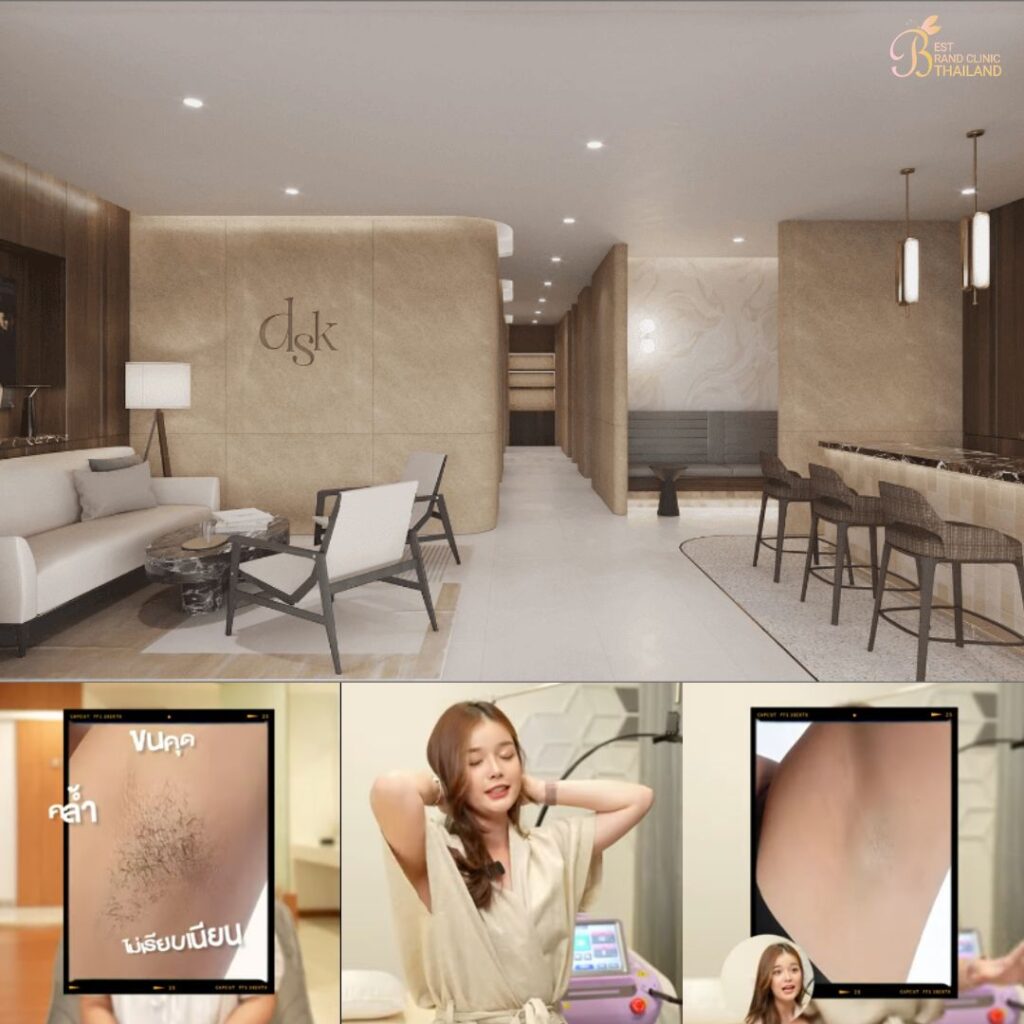 เลเซอร์ขนที่ DSK Clinic