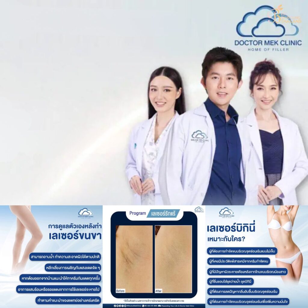 เลเซอร์ขนที่ Doctor Mek Clinic