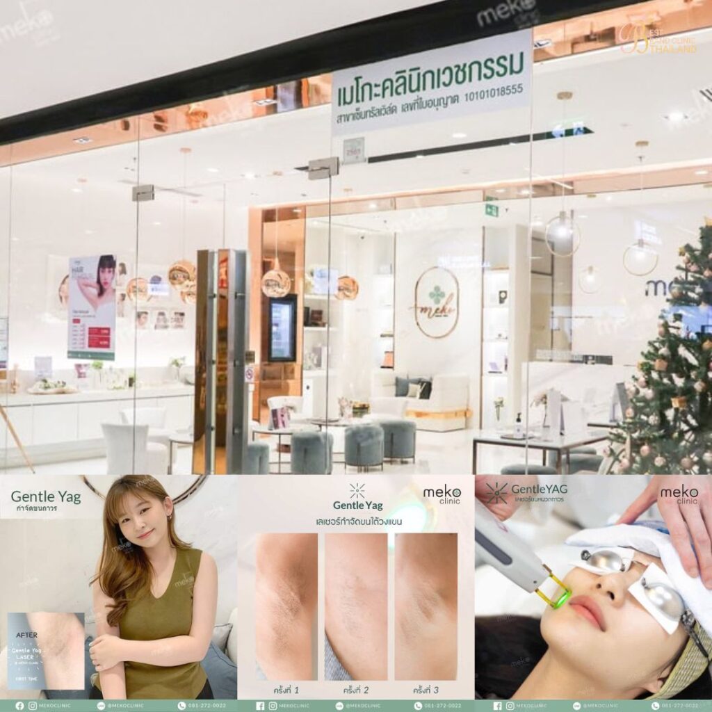 เลเซอร์ขนที่ Meko Clinic