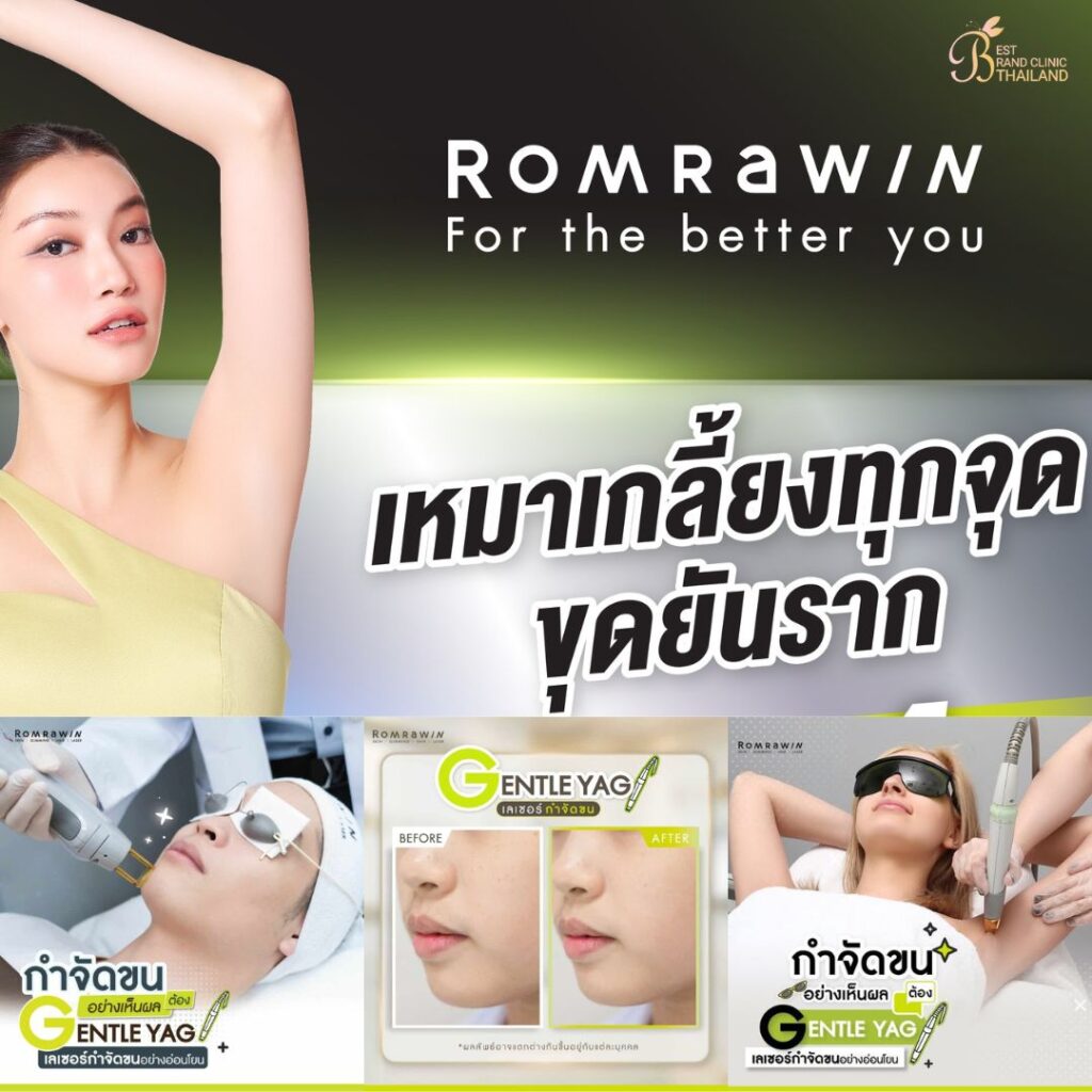 เลเซอร์ขนที่ Romrawin Clinic