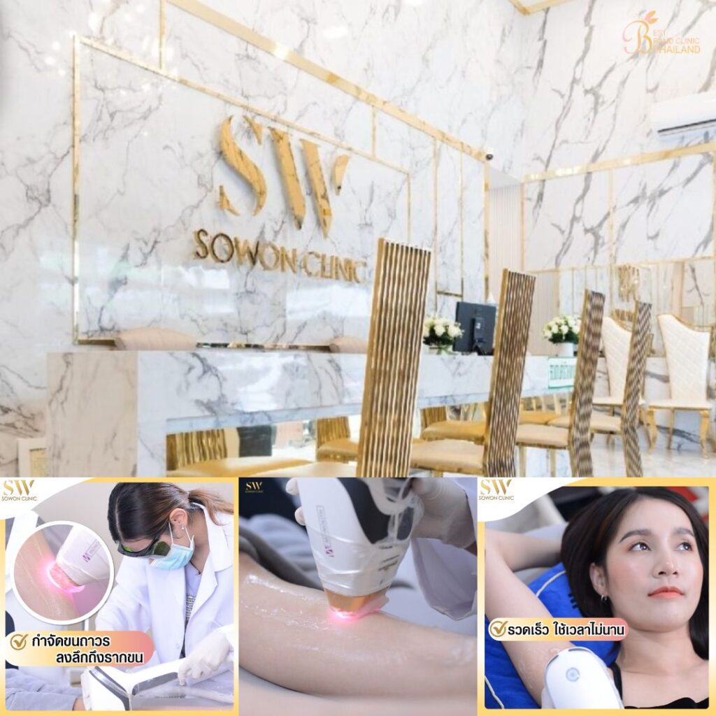 เลเซอร์ขนที่ Sowon Clinic