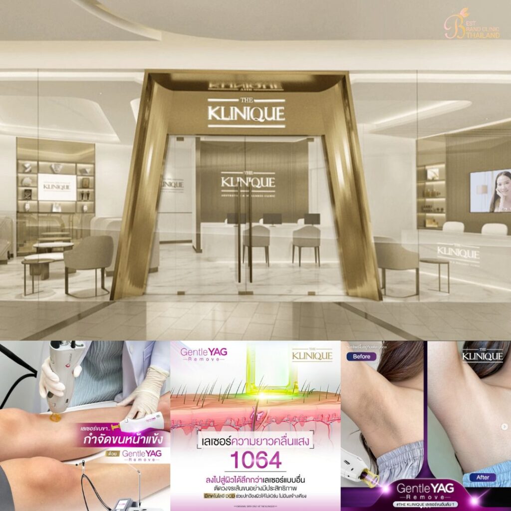 เลเซอร์ขนที่ The Klinique