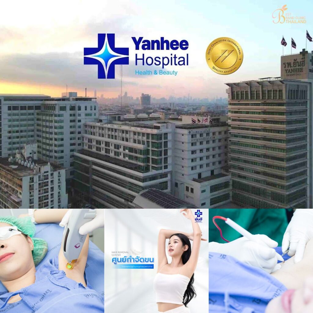เลเซอร์ขนที่ Yanhee Hospital