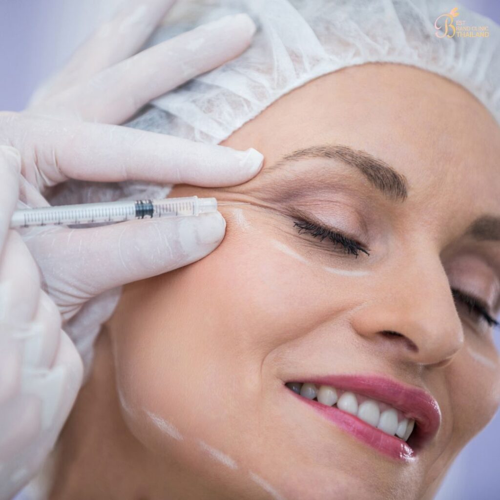 ฉีดฟิลเลอร์ใต้ตาคืออะไร ช่วยเรื่องอะไร
