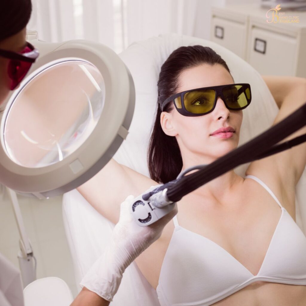 เลเซอร์ขนคืออะไร