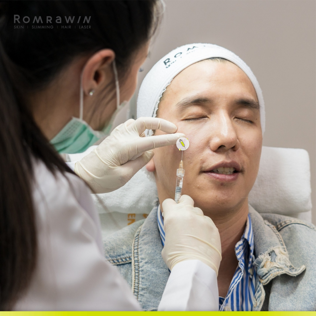 รีวิวฉีดฟิลเลอร์ใต้ตาที่ Romrawin Clinic