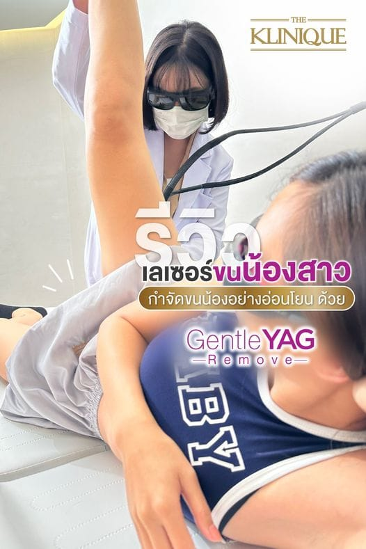 รีวิวเลเซอร์ขนน้องสาวที่ The Klinique