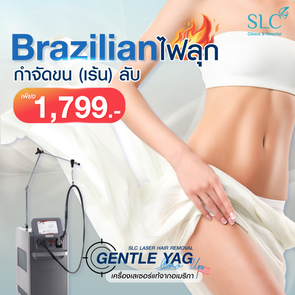 เลเซอร์ขนน้องสาวที่ SLC Clinic