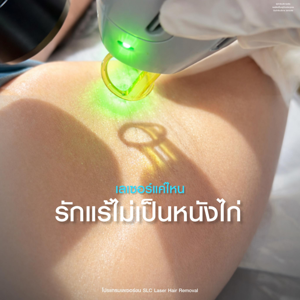 รีวิวเลเซอร์ขนรักแร้ที่ SLC Clinic