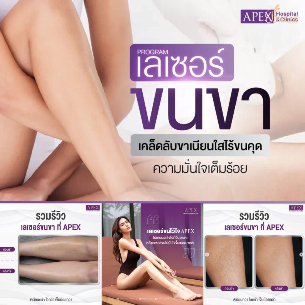 เลเซอร์ขนขาที่ Apex Medical Center