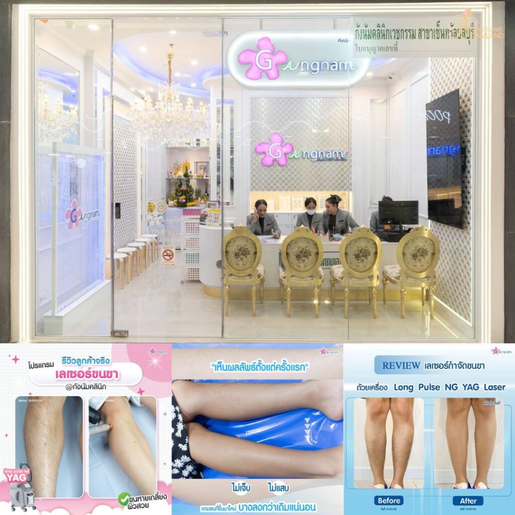 เลเซอร์ขนขาที่ Gangnam Clinic