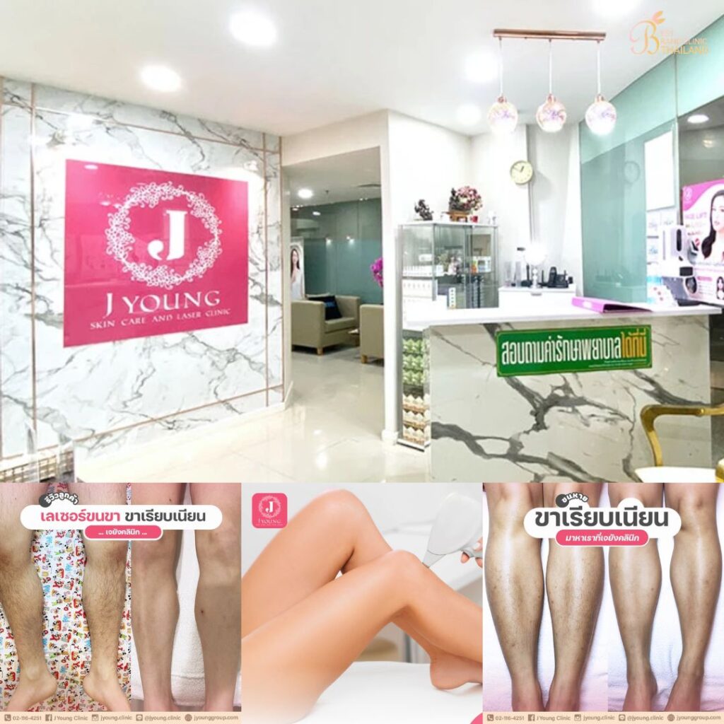 เลเซอร์ขนขาที่ J Young Clinic