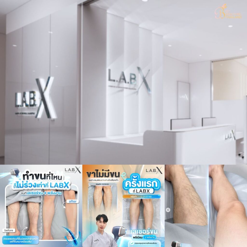 เลเซอร์ขนขาที่ Lab X Clinic