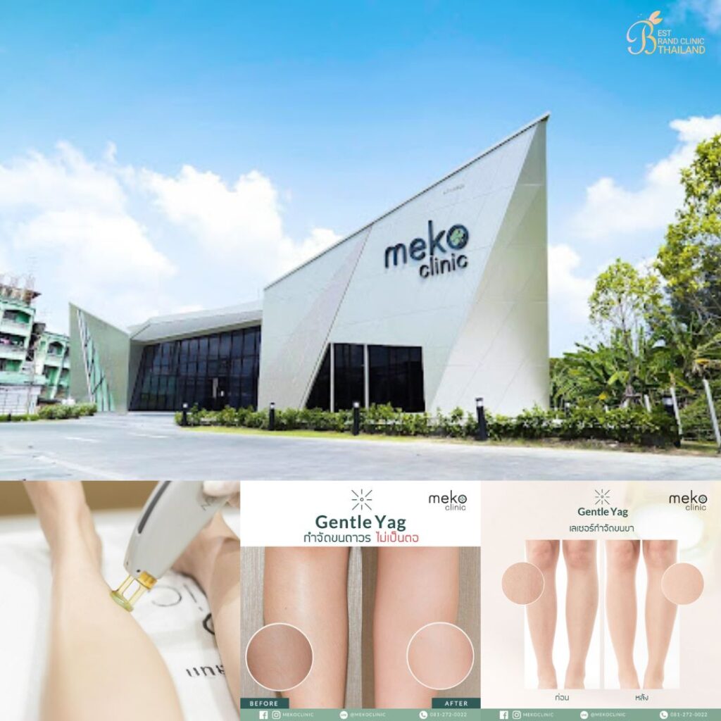 เลเซอร์ขนขาที่ Meko Clinic