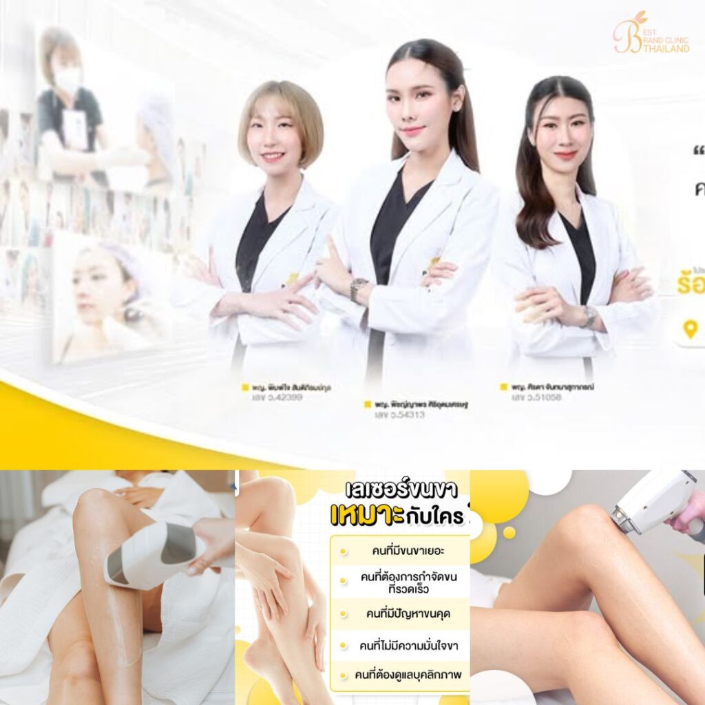 เลเซอร์ขนขาที่ Patcha Clinic