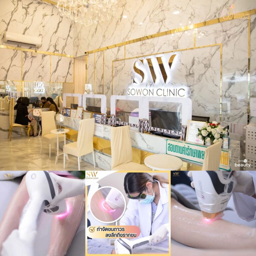 เลเซอร์ขนขาที่ Sowon Clinic