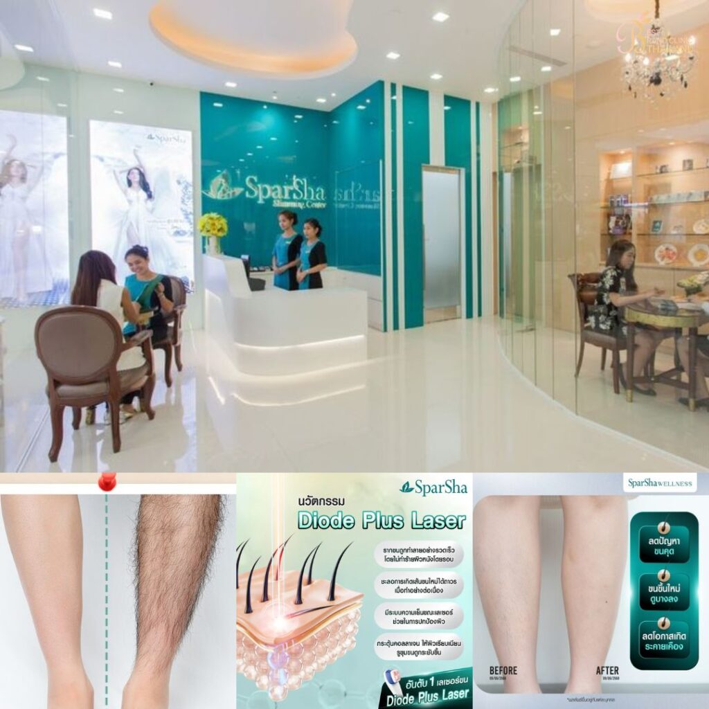 เลเซอร์ขนขาที่ Sparsha