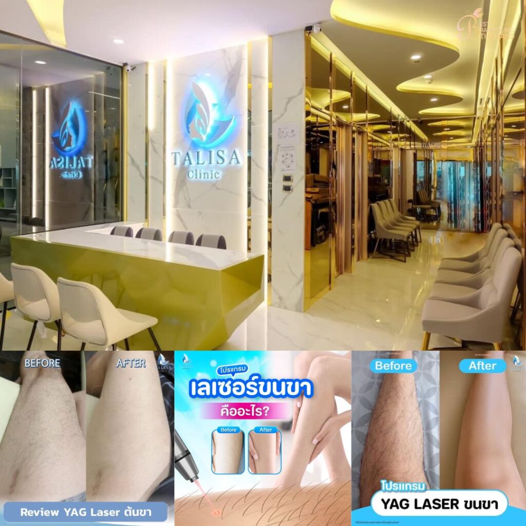 เลเซอร์ขนขาที่ TALISA Clinic