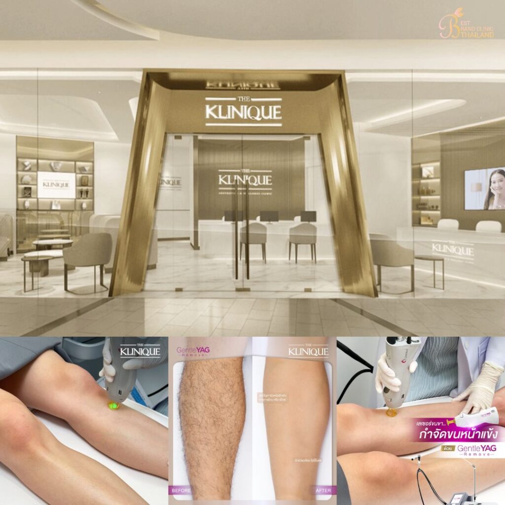 เลเซอร์ขนขาที่ The Klinique